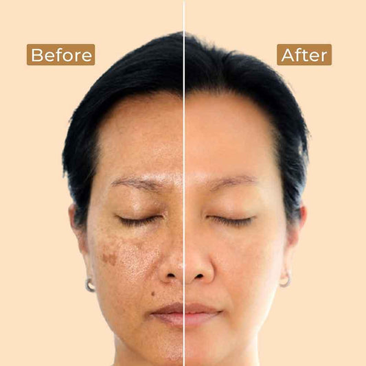 Brightening Depigmentation Gel - 100ml 100ml