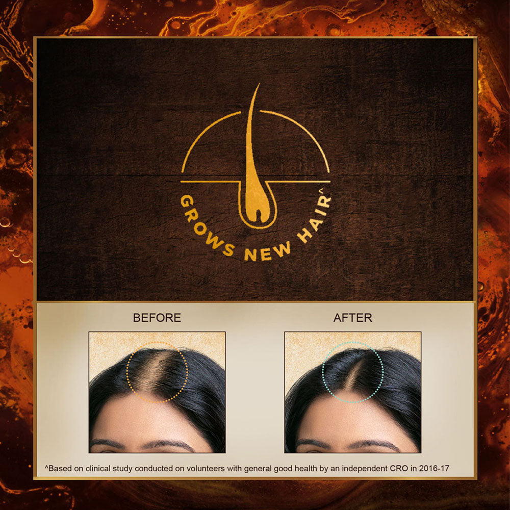 Bringha: Oil 100ml + Shampoo 200ml