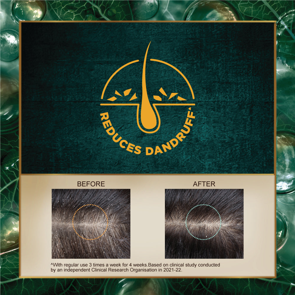 Dandruff Treatment Shampoo 100ml