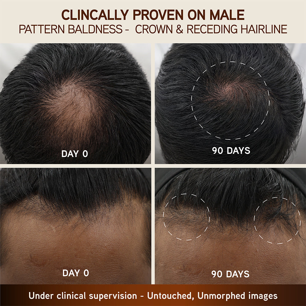 Bringha Hair Growth Treatment Scalp Serum 30ml