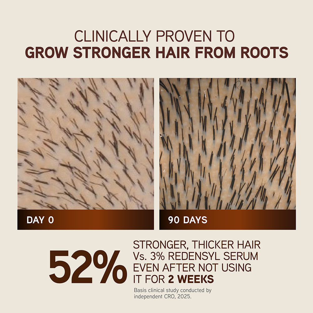 Bringha Hair Growth Treatment Scalp Serum 30ml