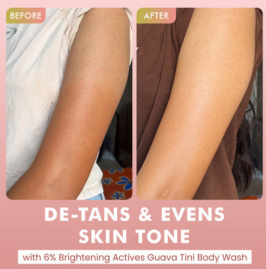 Brighten, De-Tan & Acne-Free Body Wash Combo