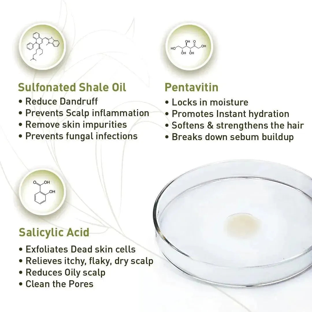 Scalp care Dandruff Removal Solution with Salicylic Acid, Tea Tree & Eucalyptus Oil,Reduces Dandruff & Flakes, Soothes Itchy scalp & Nourishes Hair 130ml