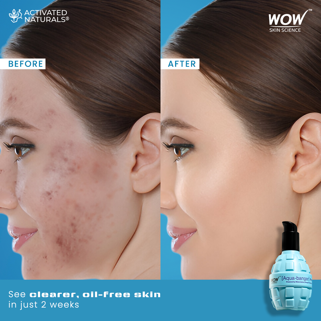Aqua Banger Face Wash