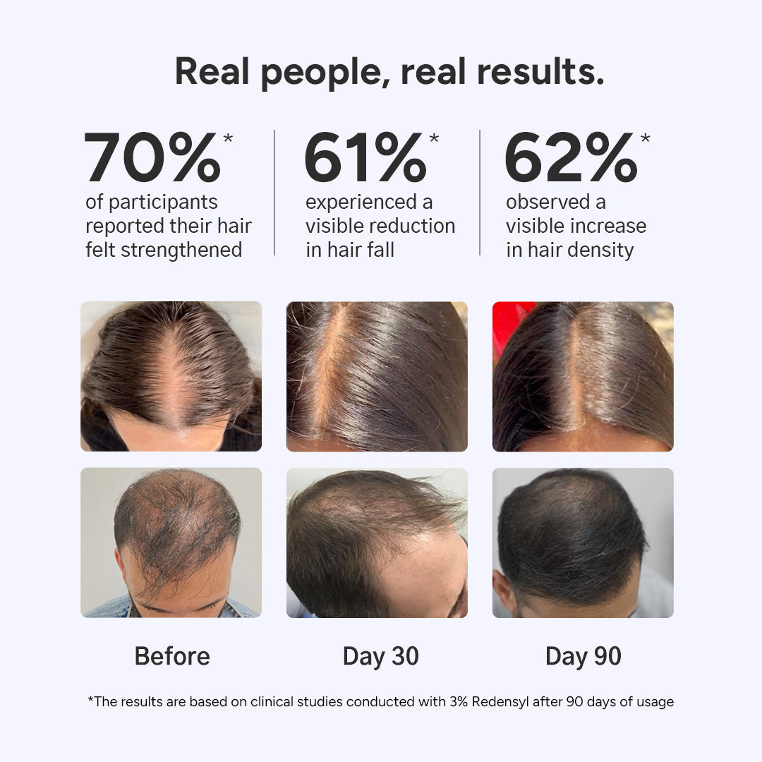 Arata Hair Growth Serum for Men and Women 30g
