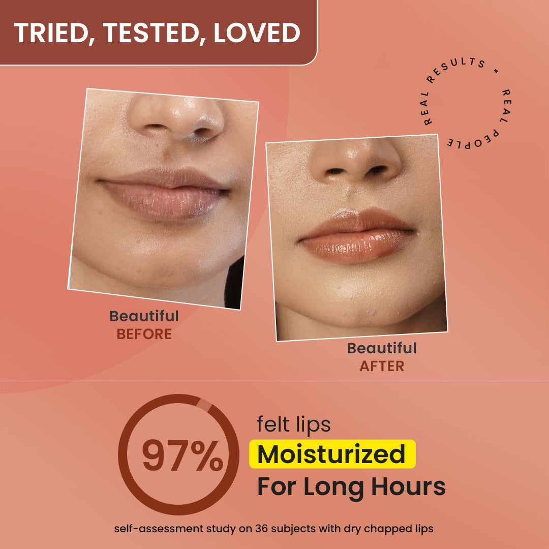 Vitamin C + E Gloss Boss Lip Balm In-Vivo Tested SPF 50+ PA+++ 
