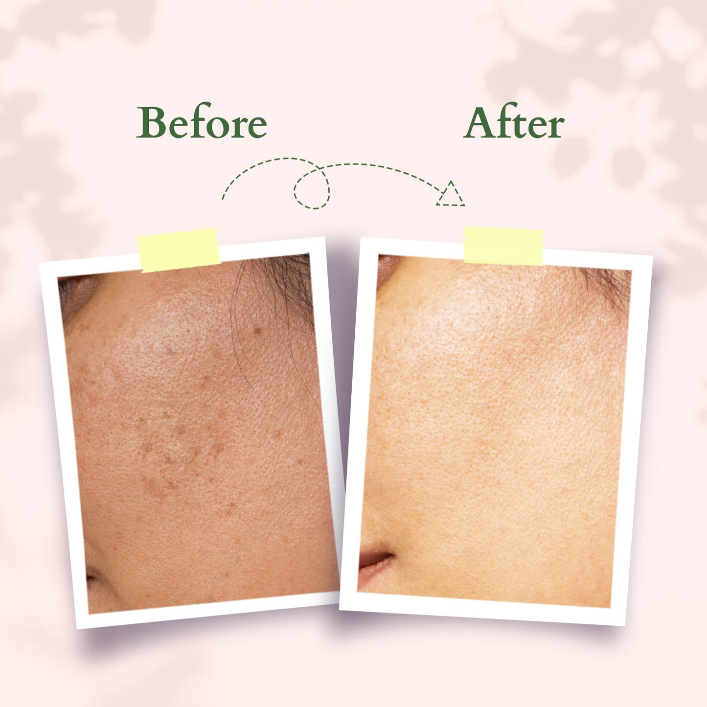 Precious Brightening Serum+ Creme 