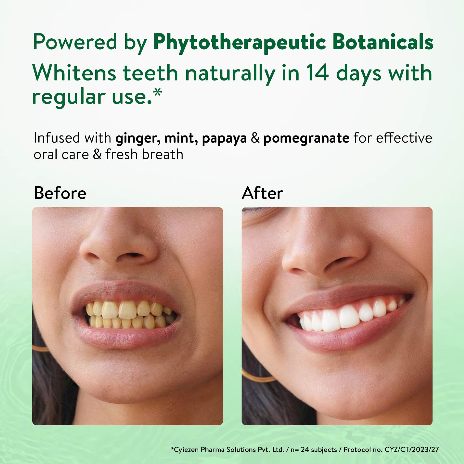 Natural Whitening Toothpaste Net qty.- 100 g each Set of 2 100g