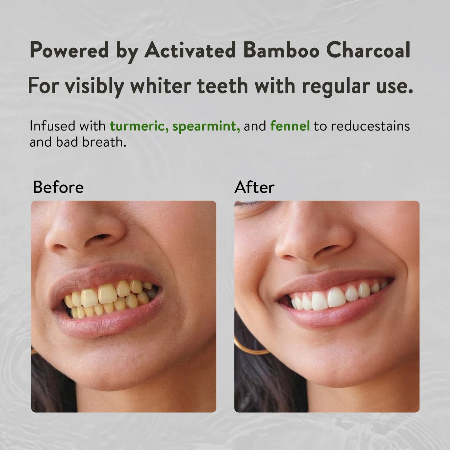 Ayurvedic Charcoal White Toothpaste with Activated Bamboo Charcoal & Turmeric for Deep Cleaning & Whitening  - 100g each (Set of 2) 100g
