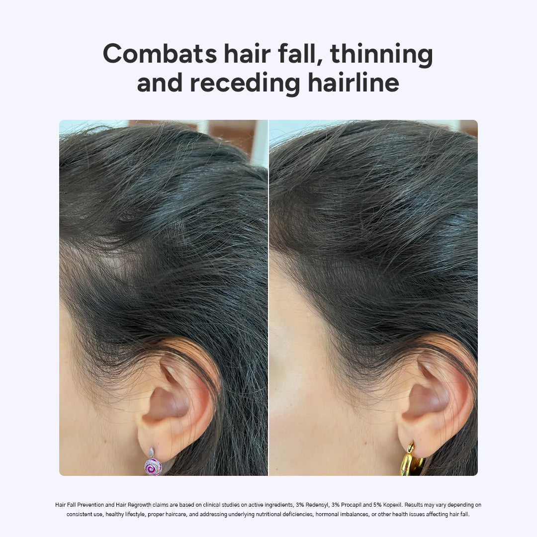 Arata Hair Growth Serum for Men and Women 30g