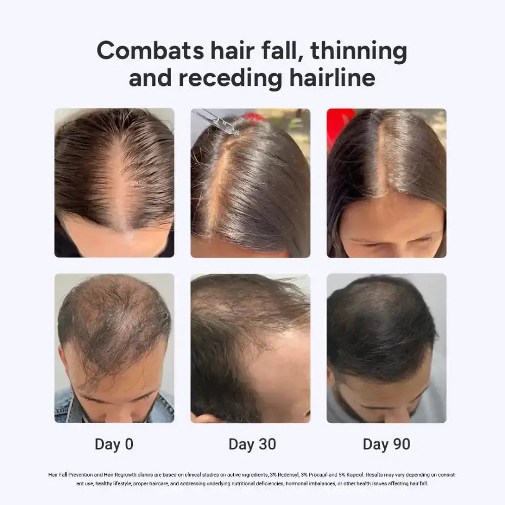 90-Day Value Pack for Fuller, Denser, Thicker Hair Regrowth 90g