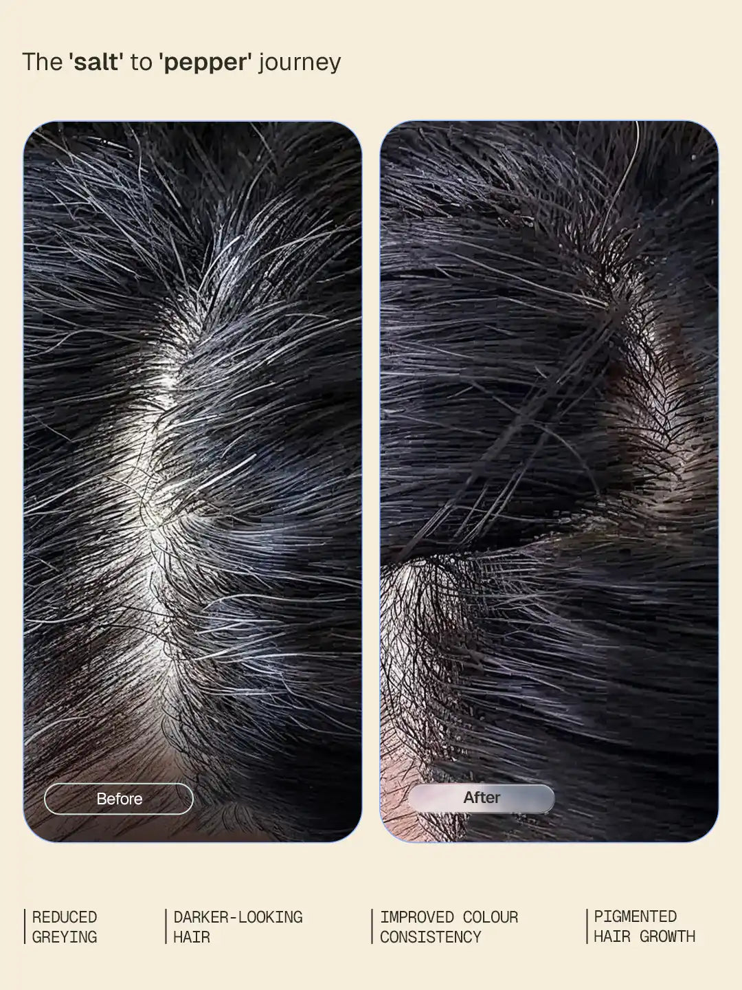 【Arata】 Anti-Grey Hair Serum - 50 ml｜アンチグレイ ヘアセラム｜50 ml
