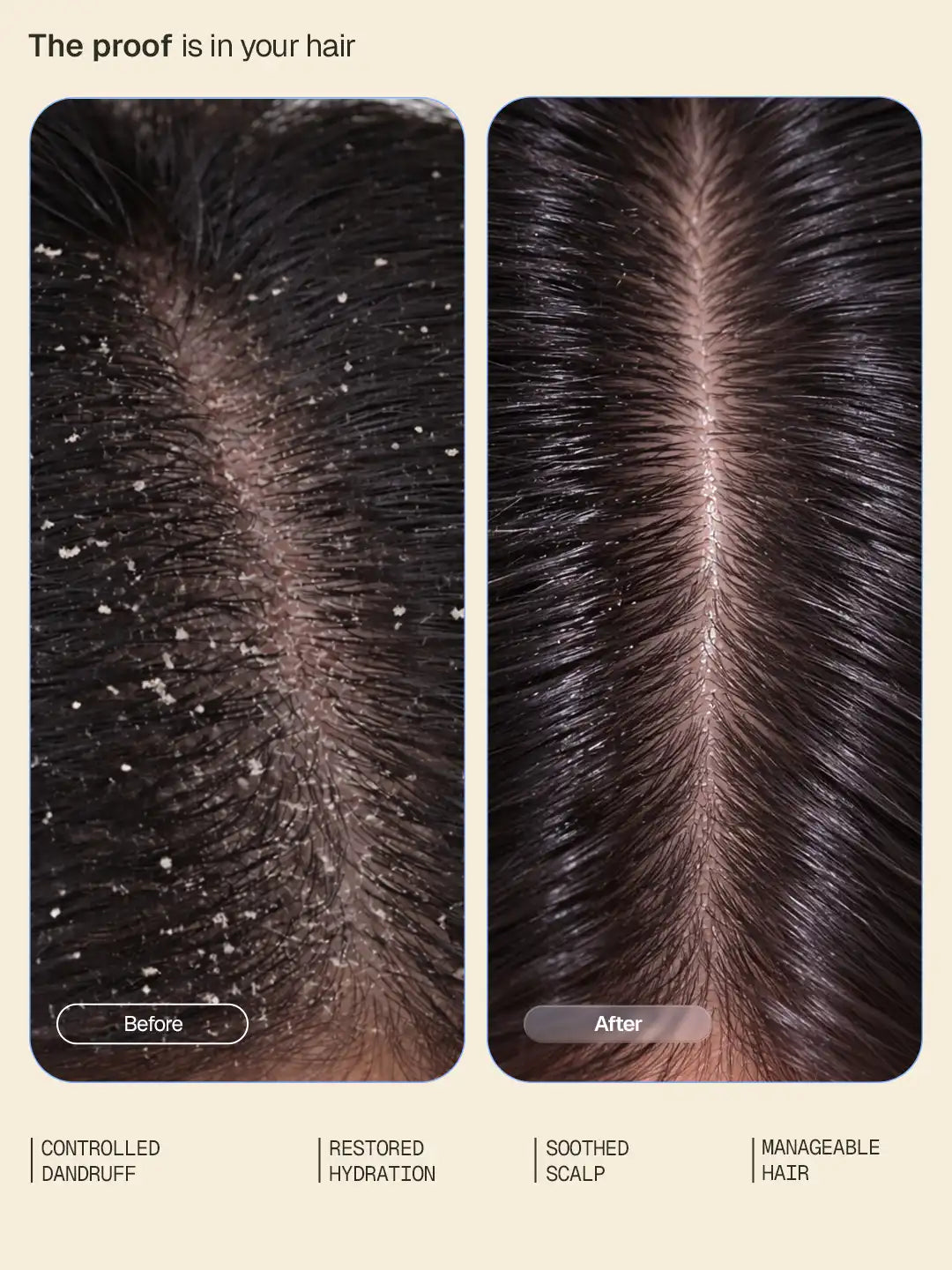 Anti-Dandruff Conditioner - 200 ml 200 ml