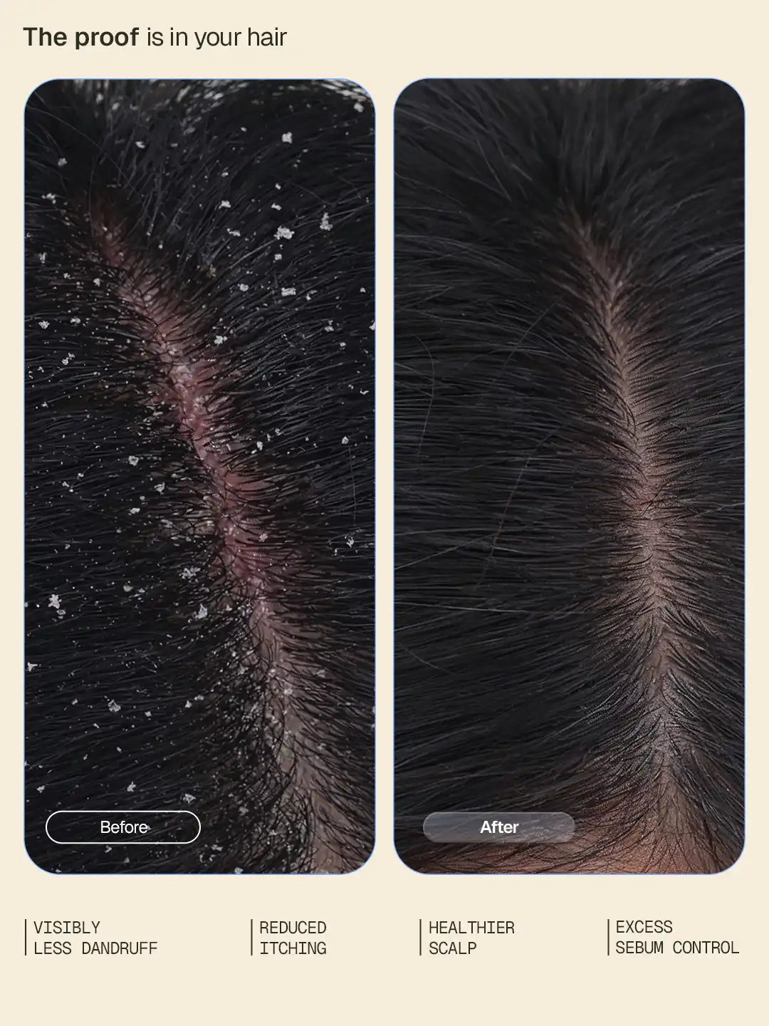 Anti-Dandruff Serum - 30 ml 30 ml