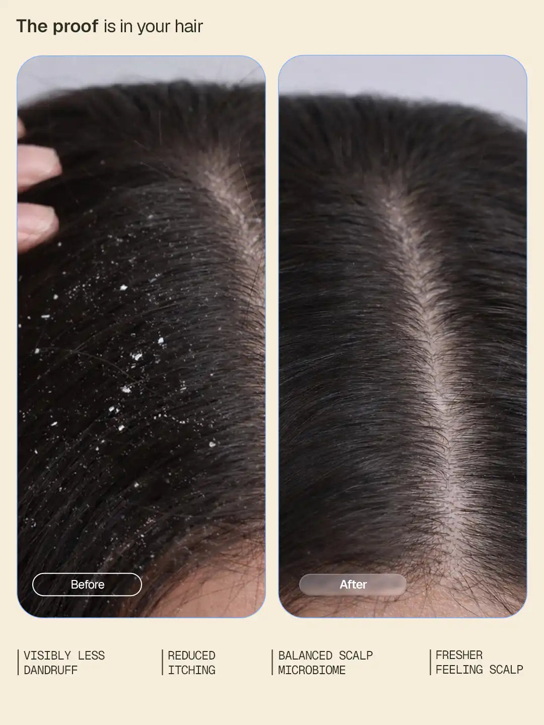 Anti-Dandruff Shampoo - 200 ml 200 ml