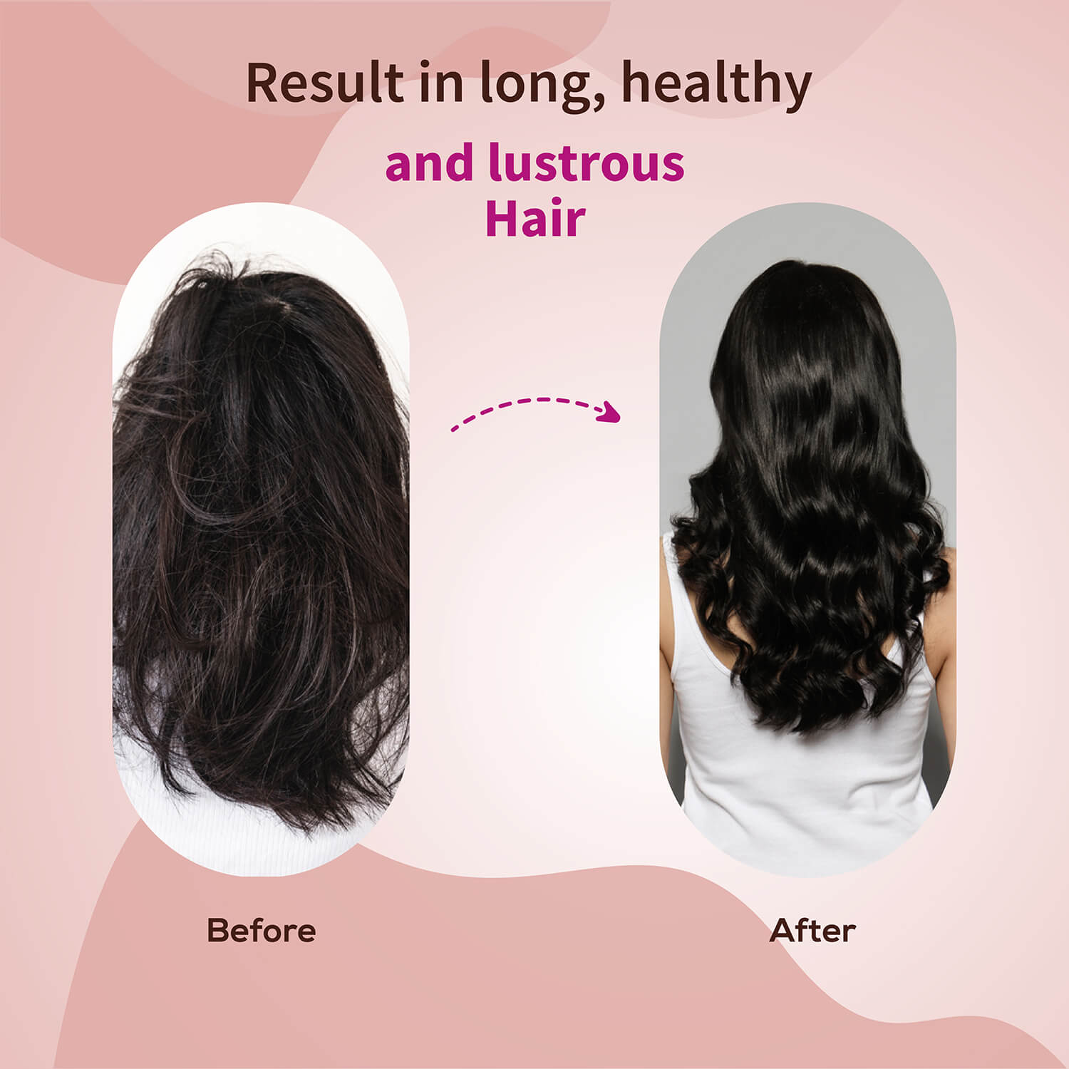 Anti-Hair Fall Shampoo with Onion and Coffee -(Net Qty- 200ml) 200ml