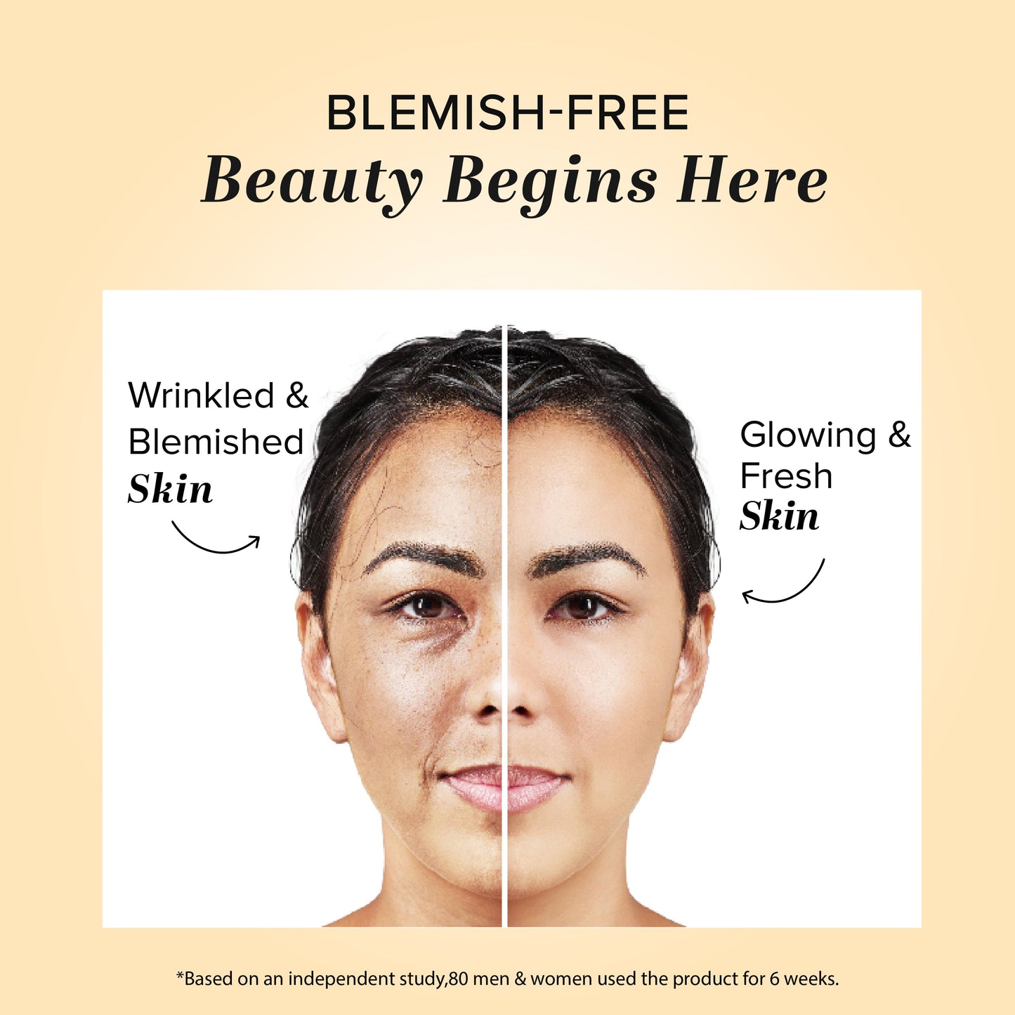 Herbal Anti Blemish Cream 50gm
