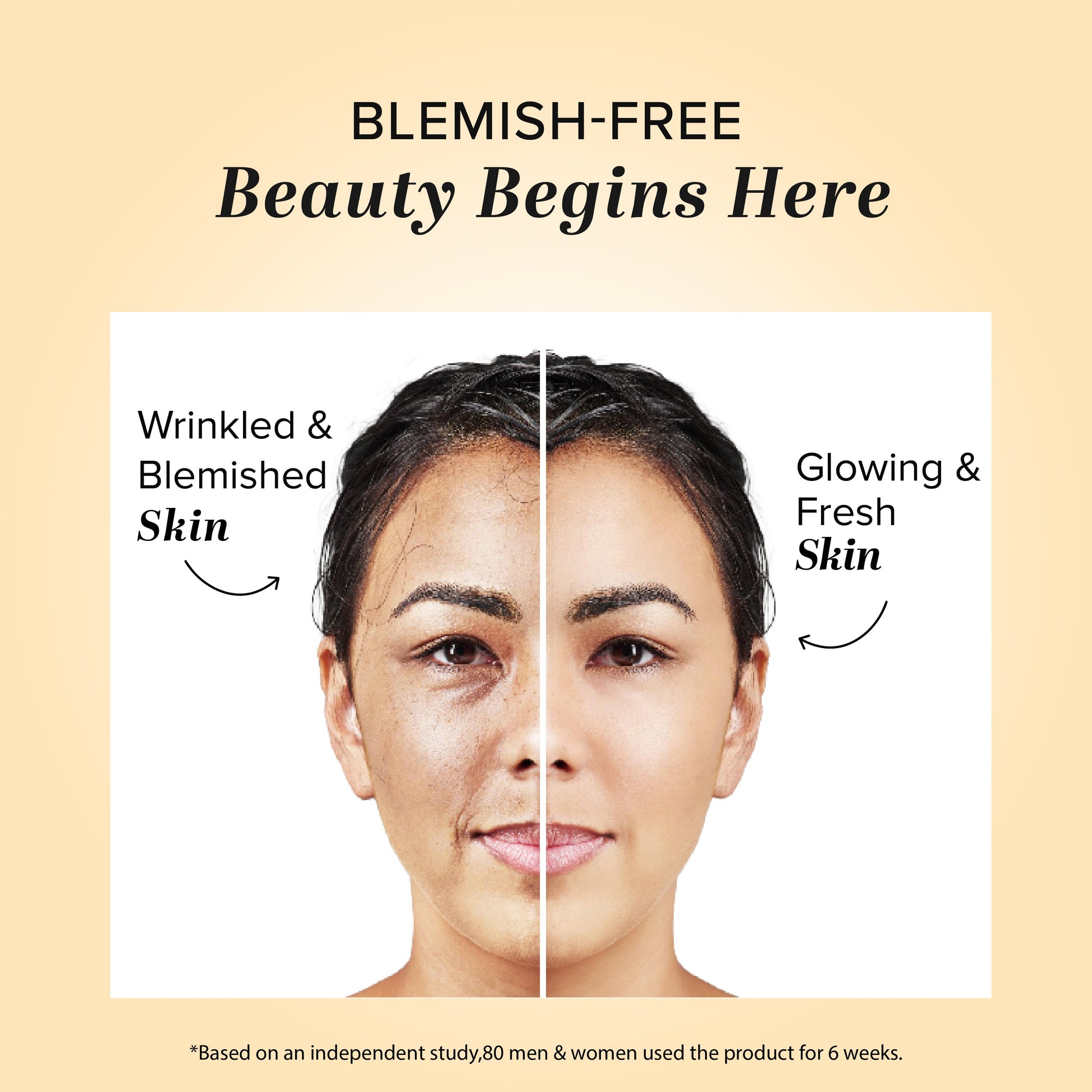 Herbal Anti Blemish Cream 50gm