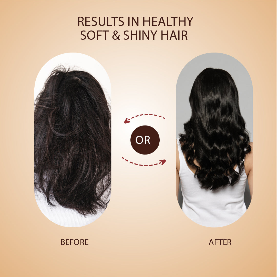 Anti-Hair Fall Tonic For Hair Fall Control & Re-growth -( Net Qty- 100ml) 100ml