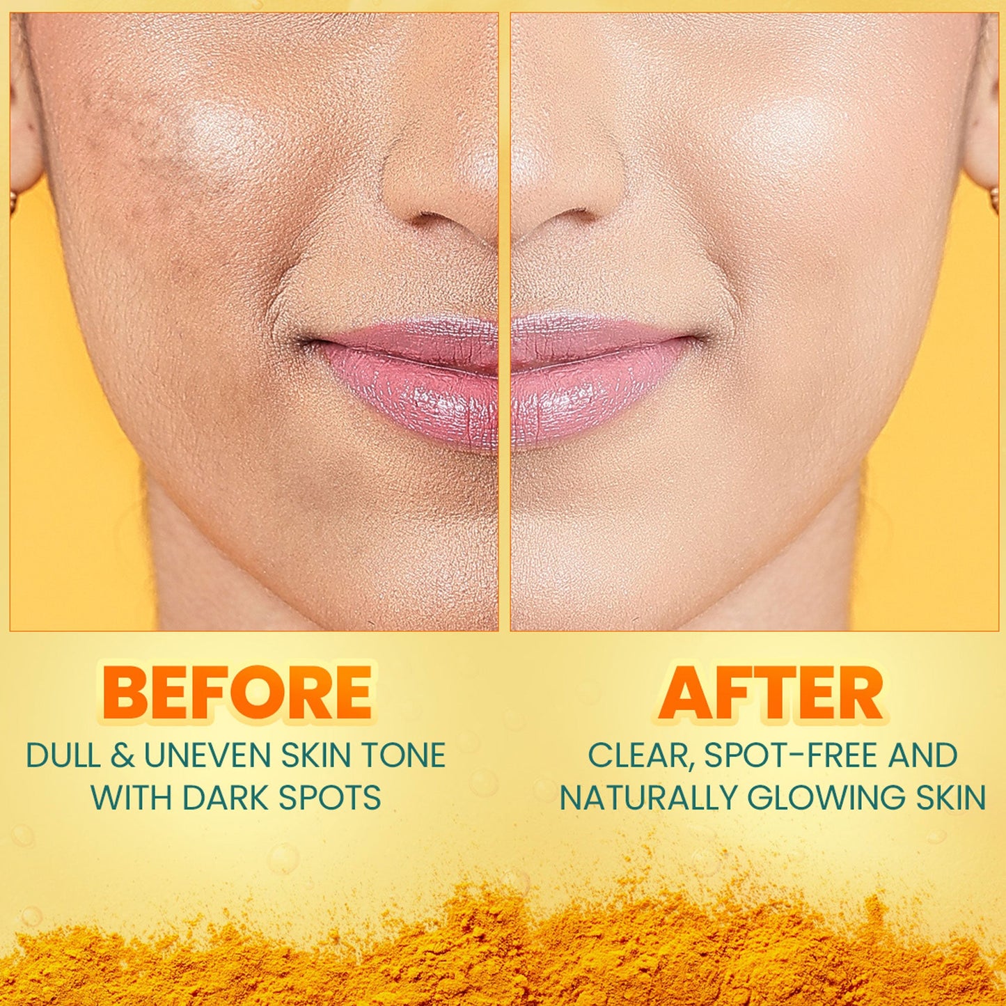 Dark Spot Clearing Turmeric Kit Kit