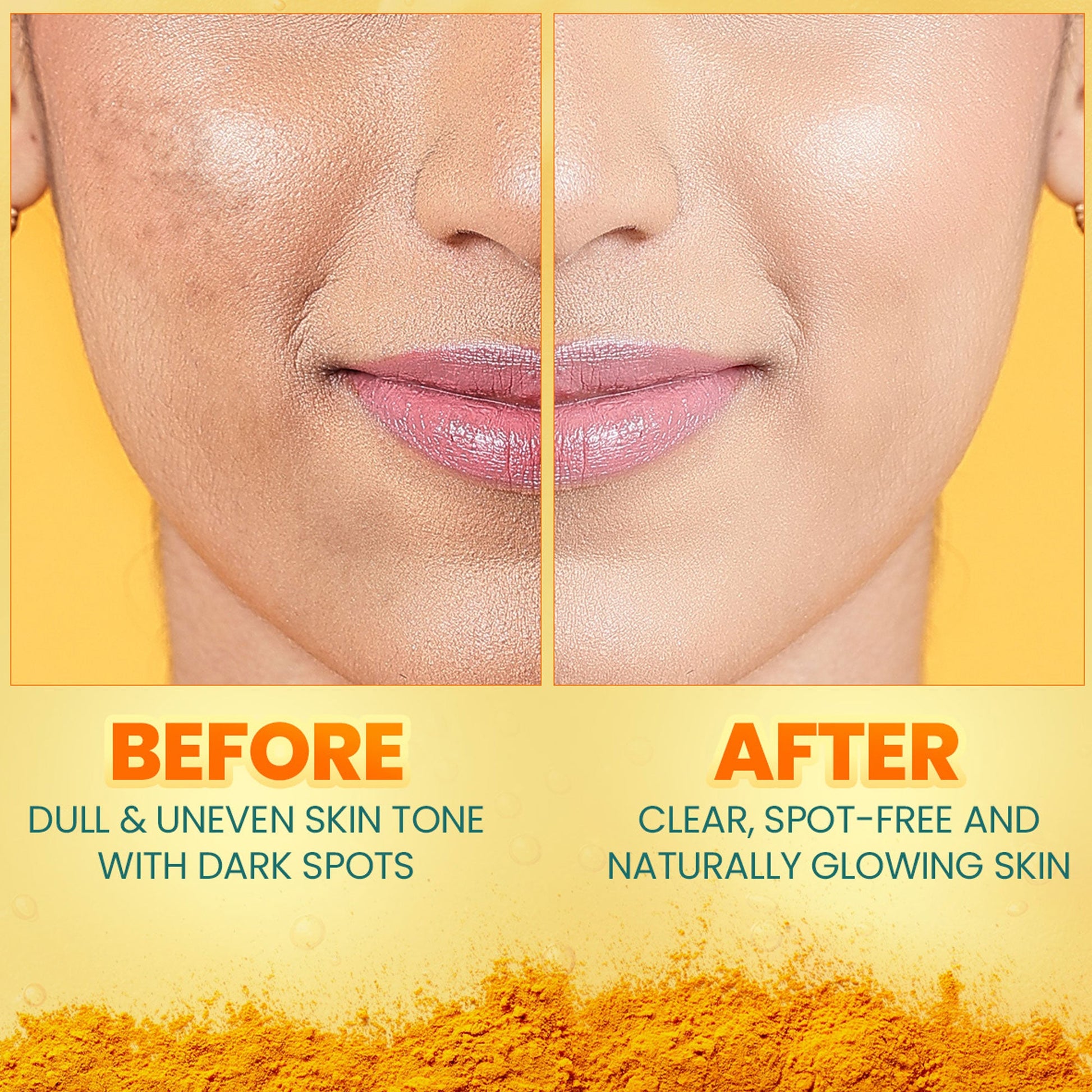 Dark Spot Clearing Turmeric Kit Kit