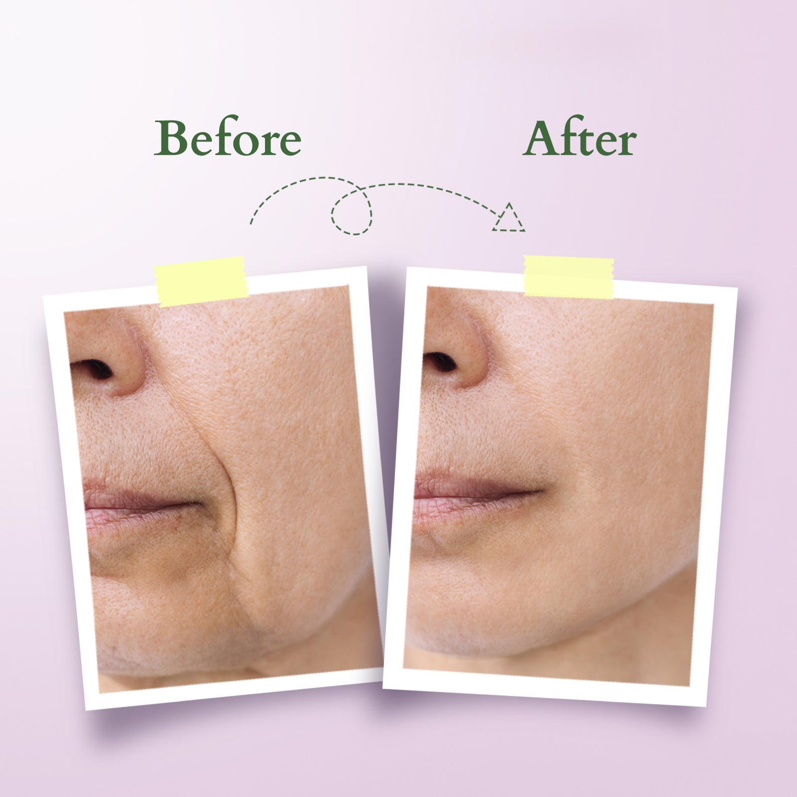 Bakuchiol Plant Retinol Crème 