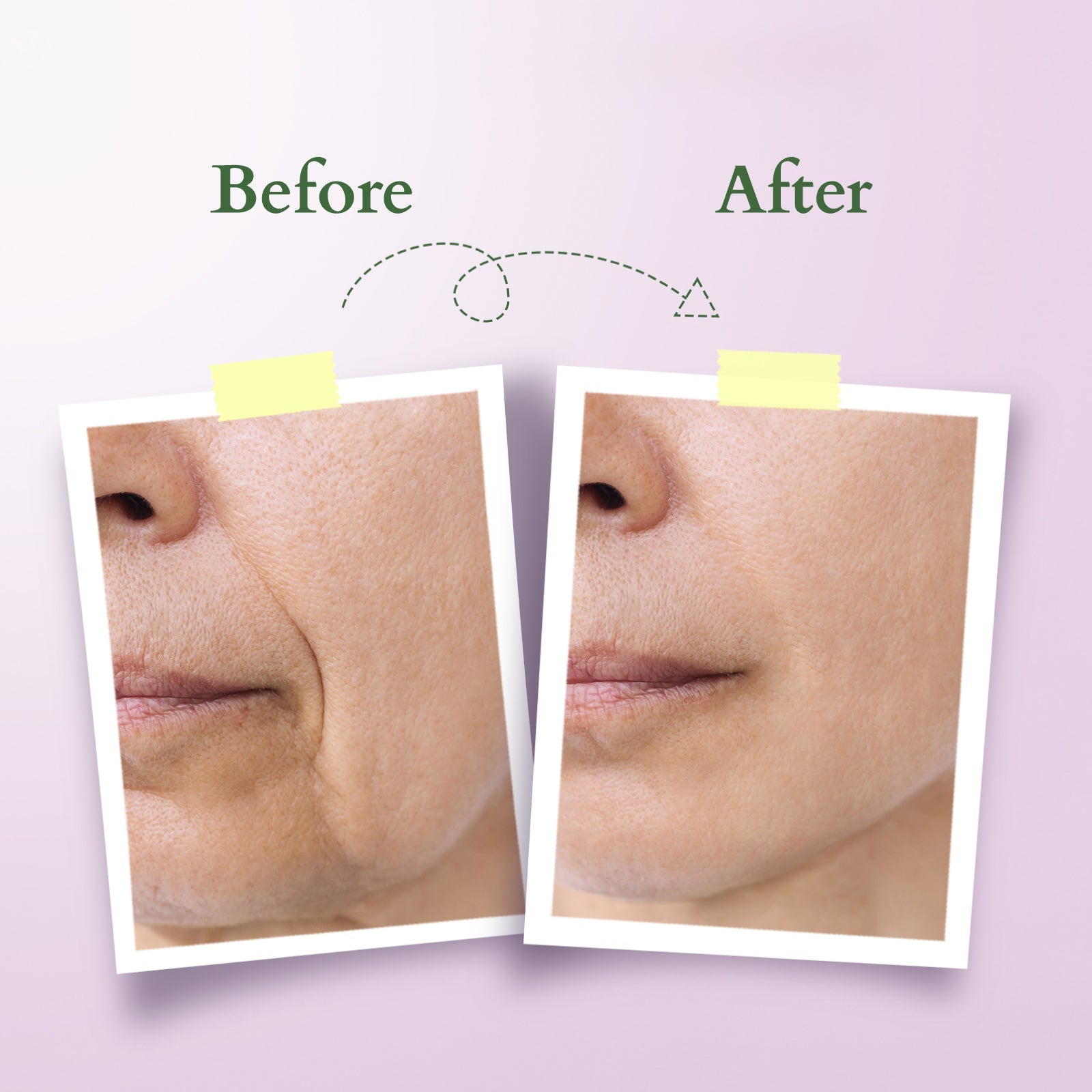 Bakuchiol Plant Retinol Super Serum 