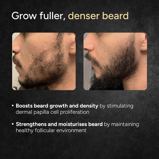 Beard Growth Oil - 30ml 30ml