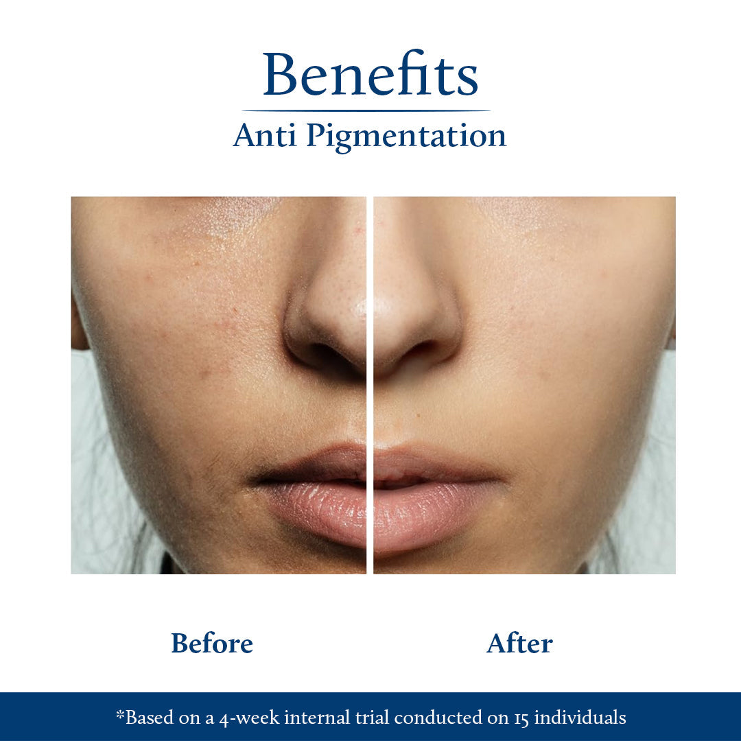 Shubhr Kojic Acid Serum for Pigmentation and Dark Spots with Rice Water and Mushroom(13 herbs, 30ml) 30ml