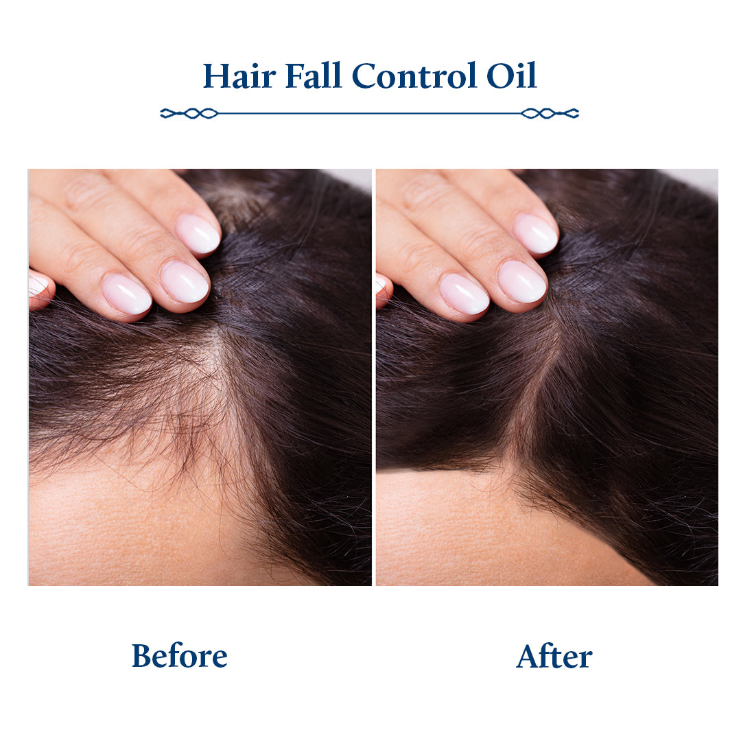 Bhringraj Hair fall Control Oil for Healthy Scalp (10 Herbs) 200ml