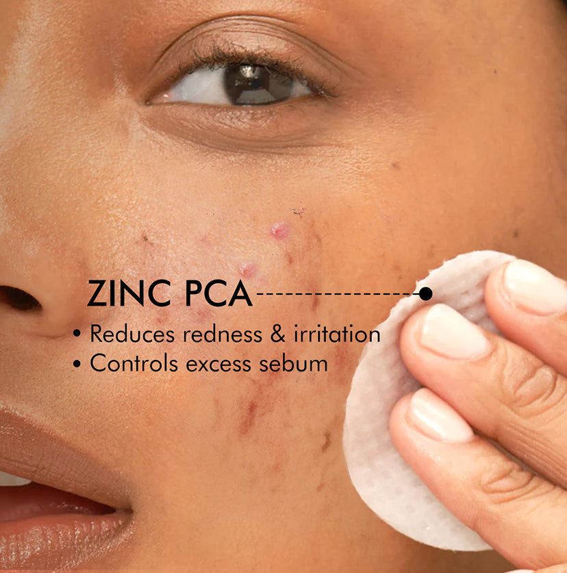 2% Salicylic Acid Serum-Acne Pads with Matcha Tea - 40 N