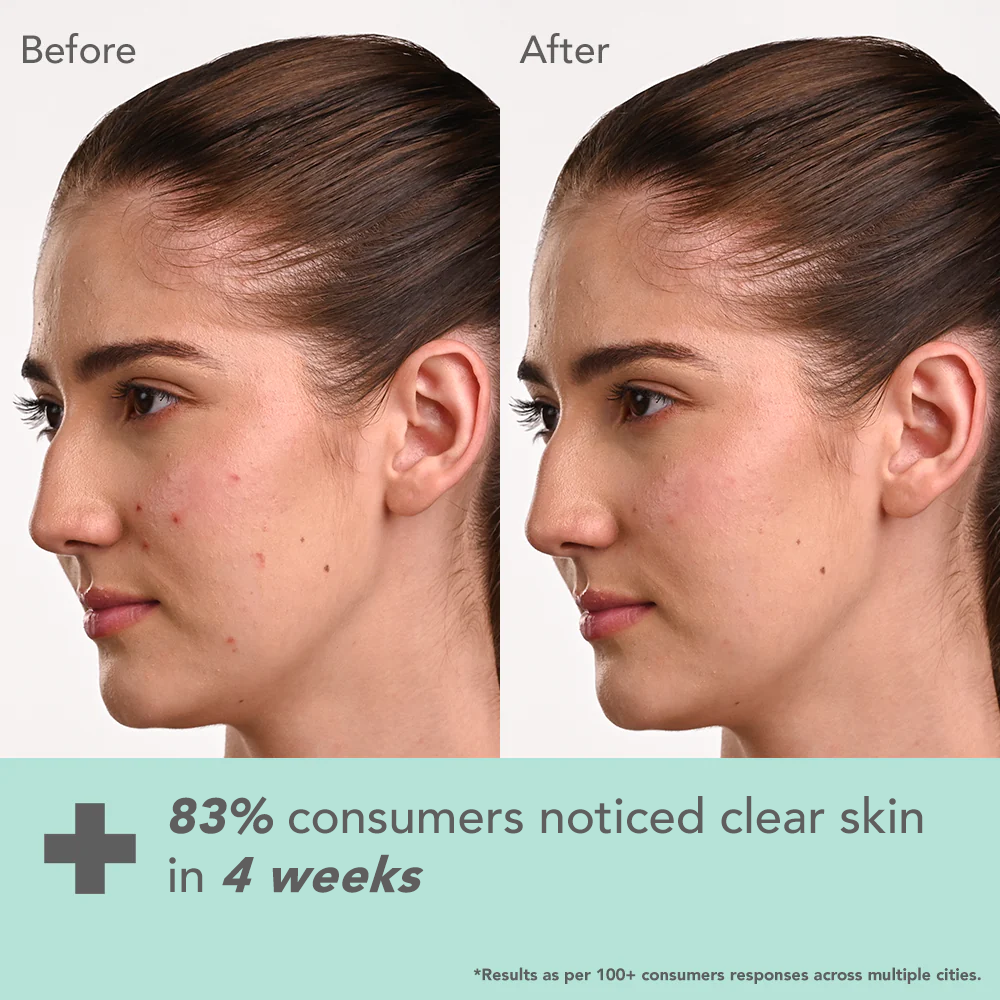 DermaBotanics Kojic acid + Multi berry Ampoule Crème 50 g