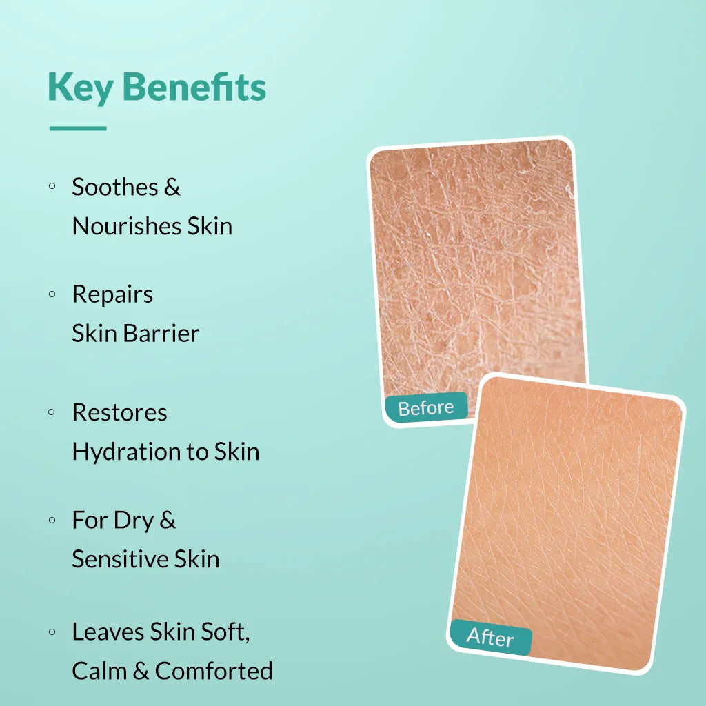 Dewrav Body Lotion For Dry & Sensitive Skin