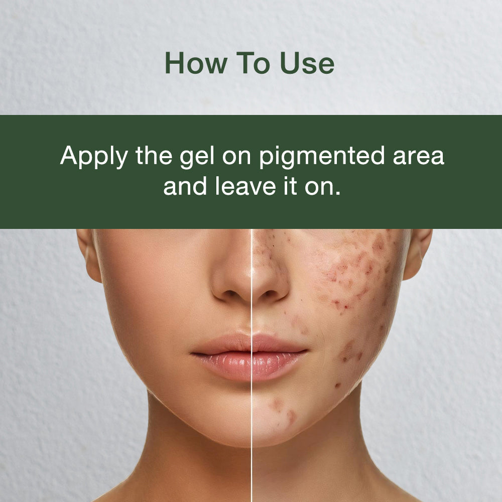 Anti Pigmentation Gel 40ml