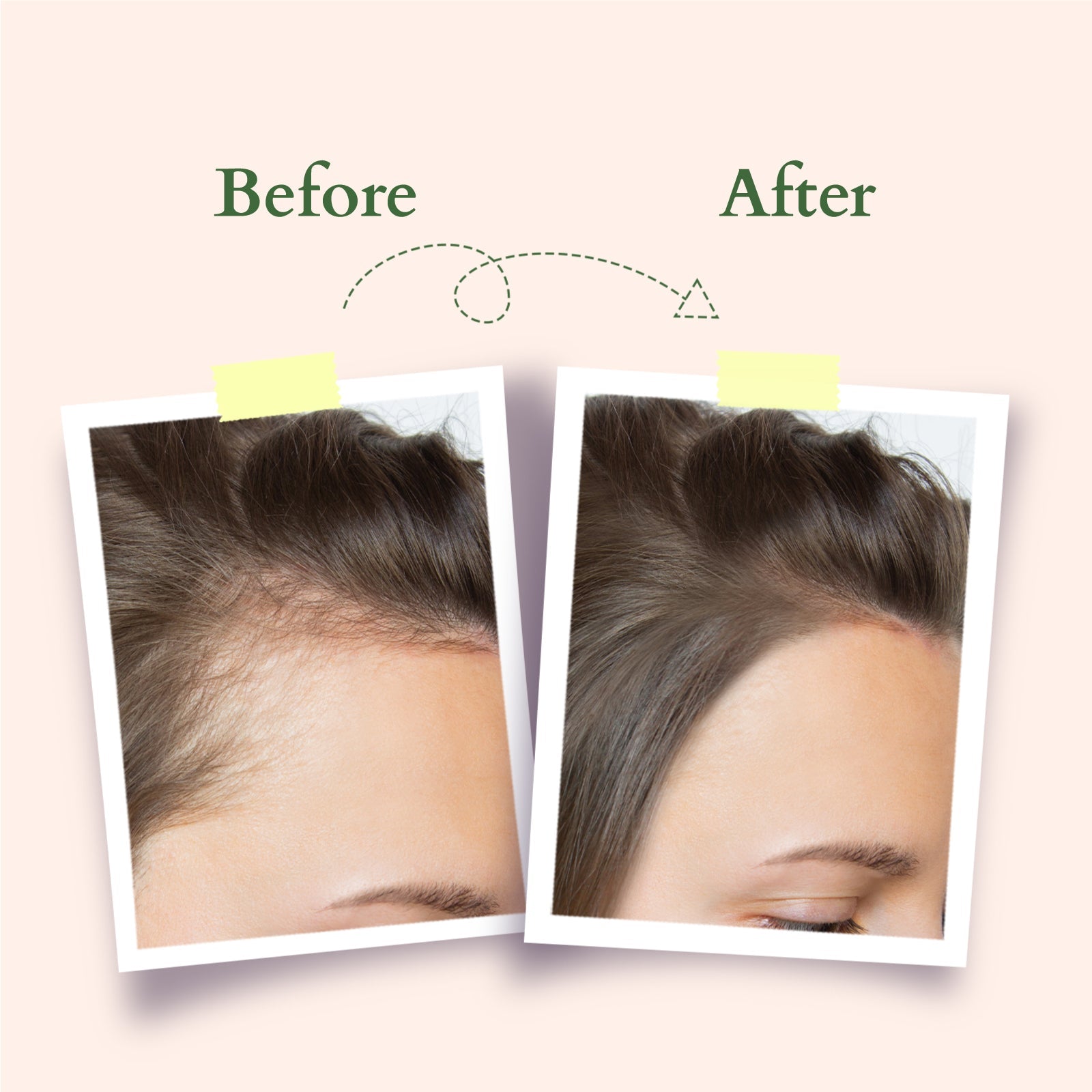Organics+ Hair Fall Control Multi Herbs Oil 200ml