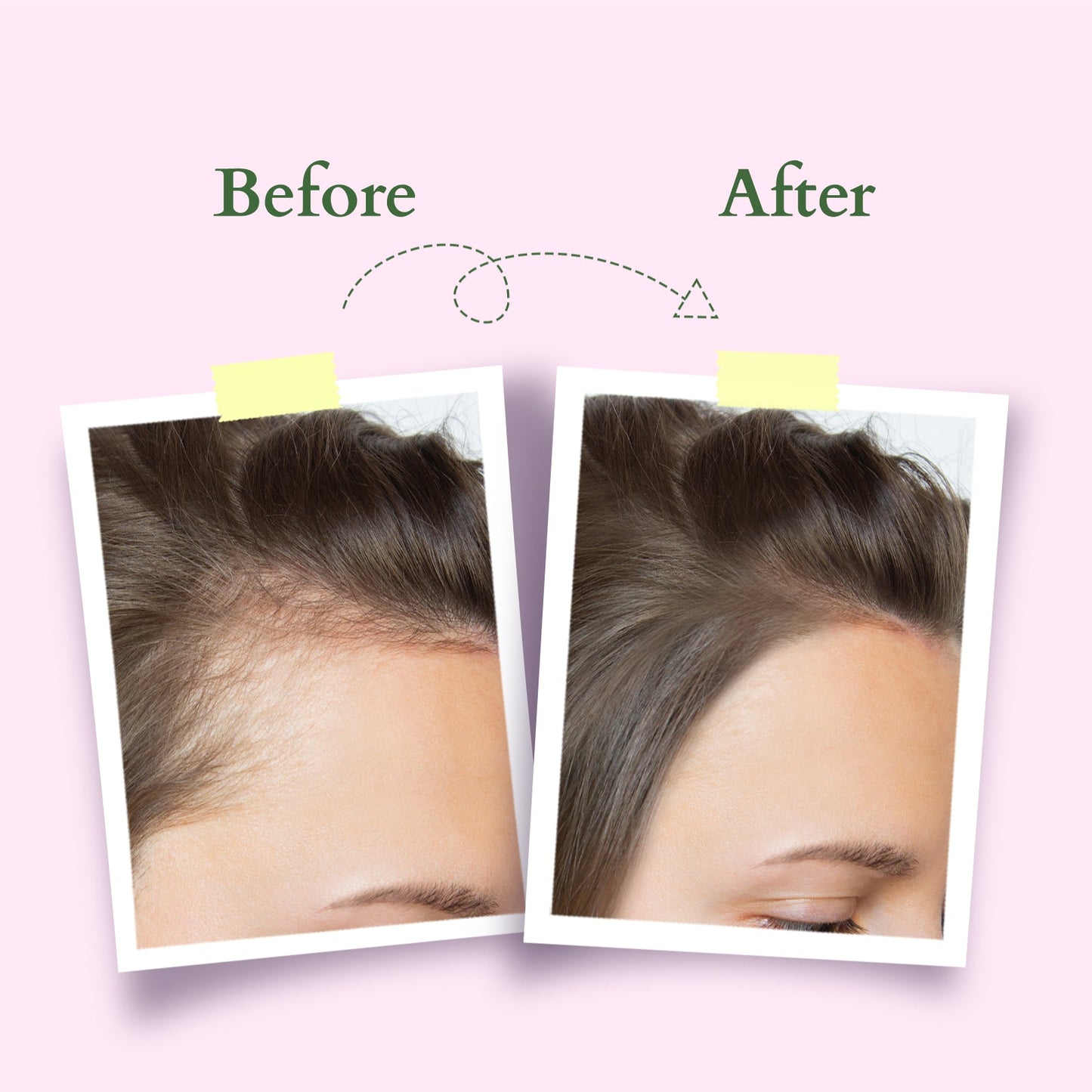 Organics+ Hair Growth Active-Concentrate Serum 