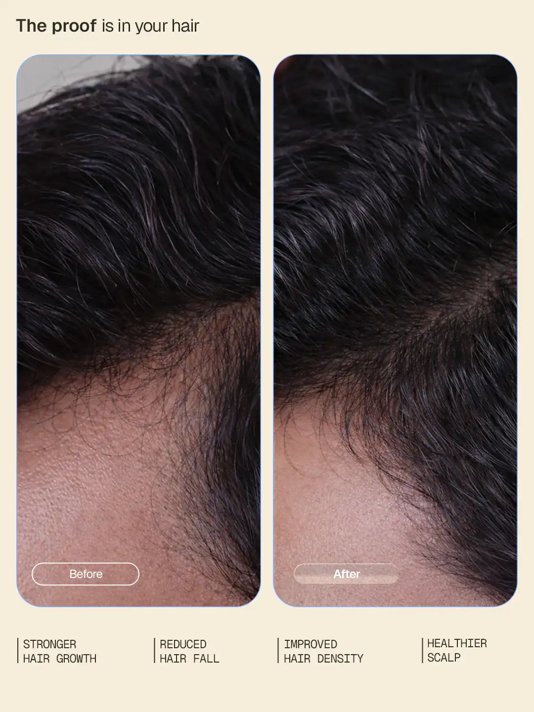 Hair Growth Intensive Serum - 30 ml 30 ml