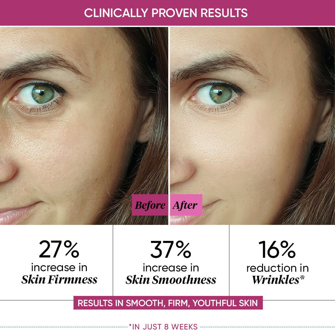 Night Reset Retinol + Ceramide Cream: 15 ml-FREE 15ml
