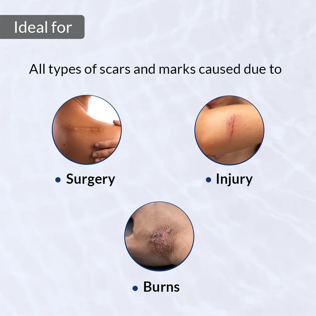Scar Gel for Scars