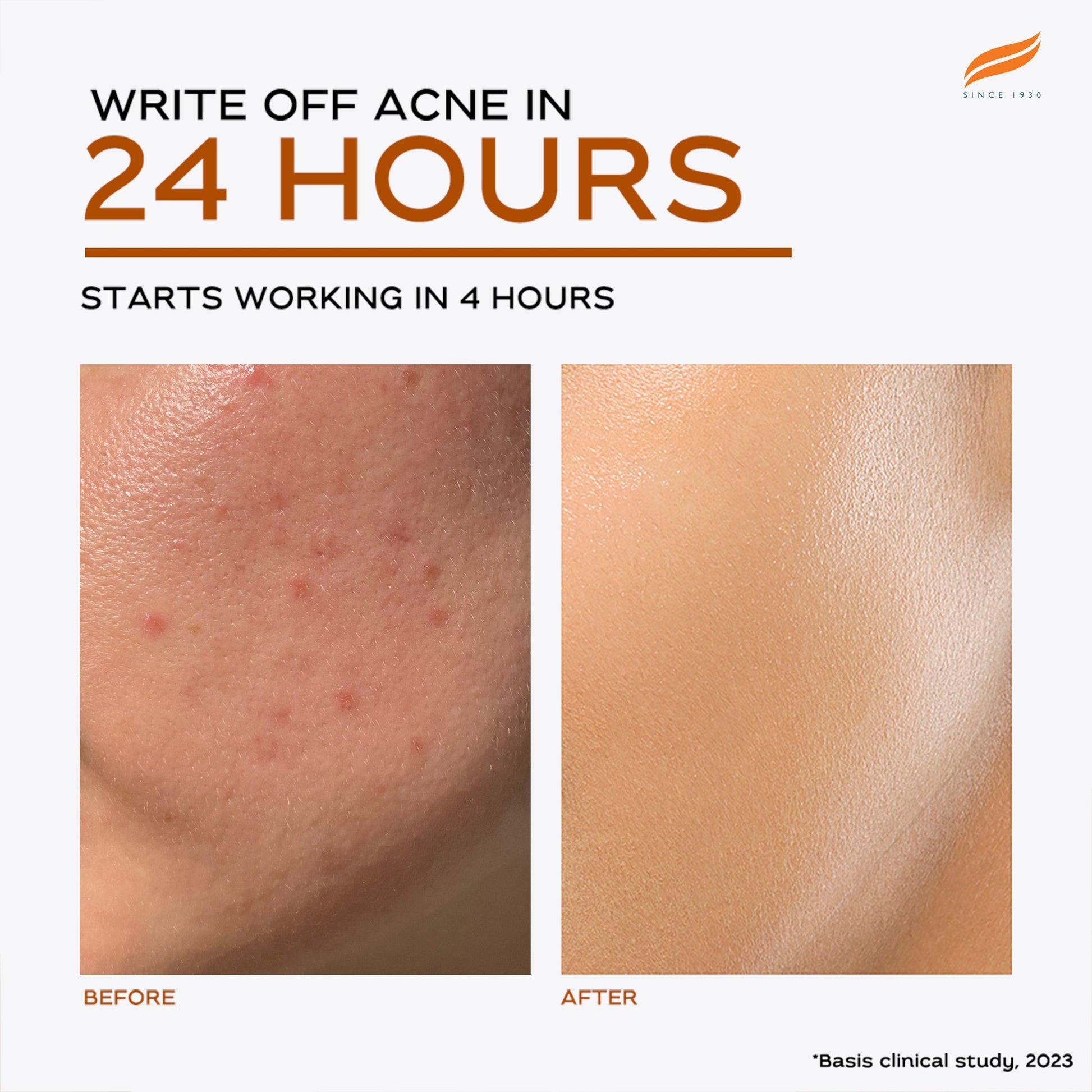 Acne Clear+ Treatment Pen 15ml
