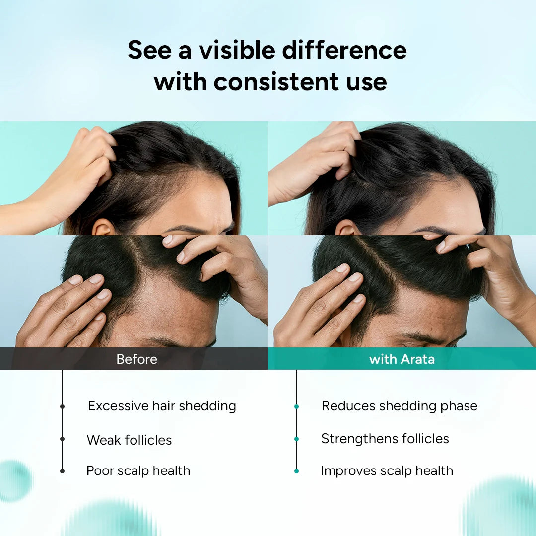 Multi-Active Anti-Hair Fall Shampoo for Hair Thinning & Hair Fall Reduction 200g