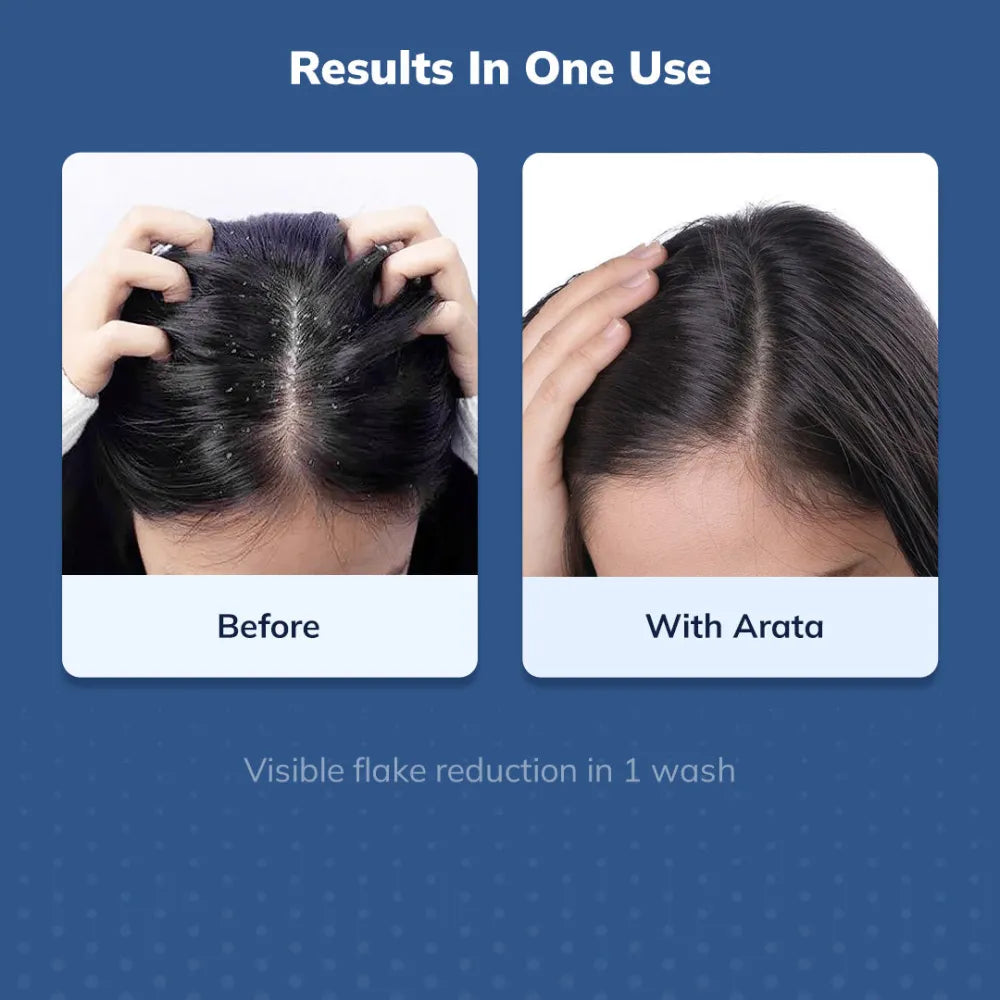 Arata Anti-Dandruff Serum (Tonic) for Women and Men 100ml