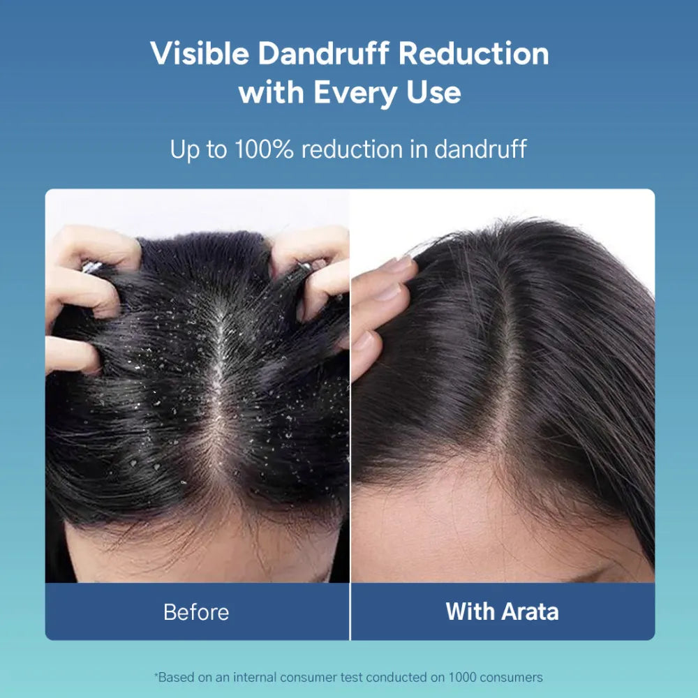 Anti-Dandruff Shampoo (Normal to Oily Hair) - 200ml 200ml