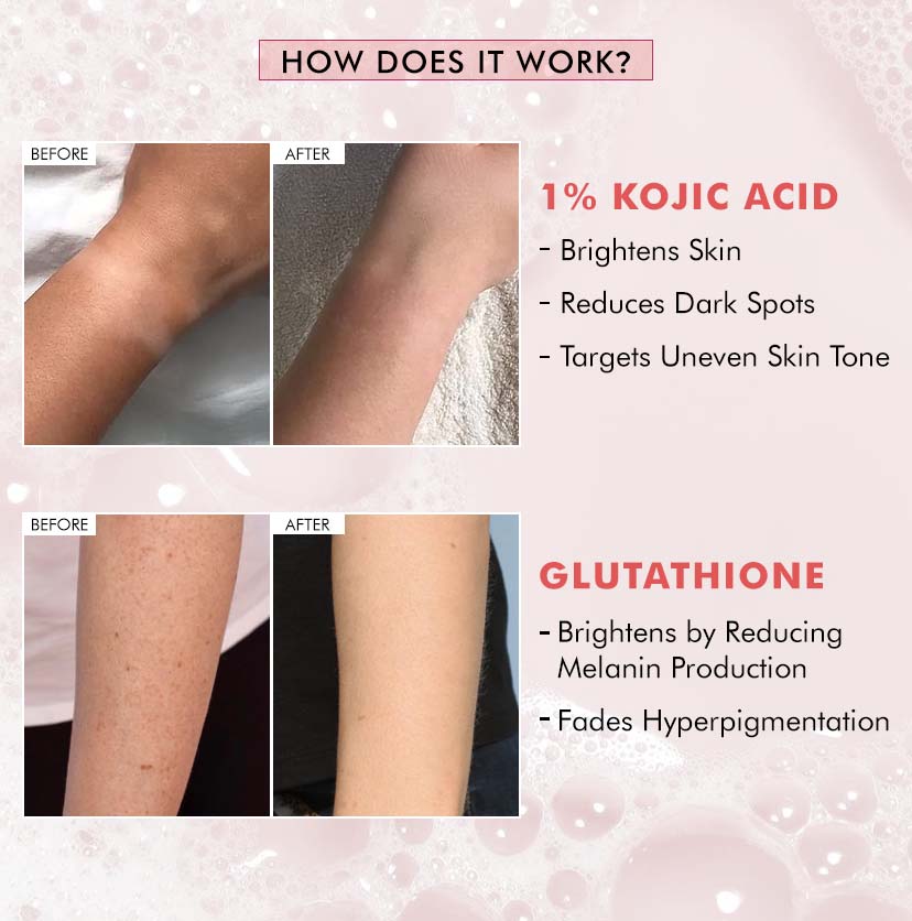 1% Kojic Acid & Glutathione Guava Fizz Soap - 300g (3x100g)
