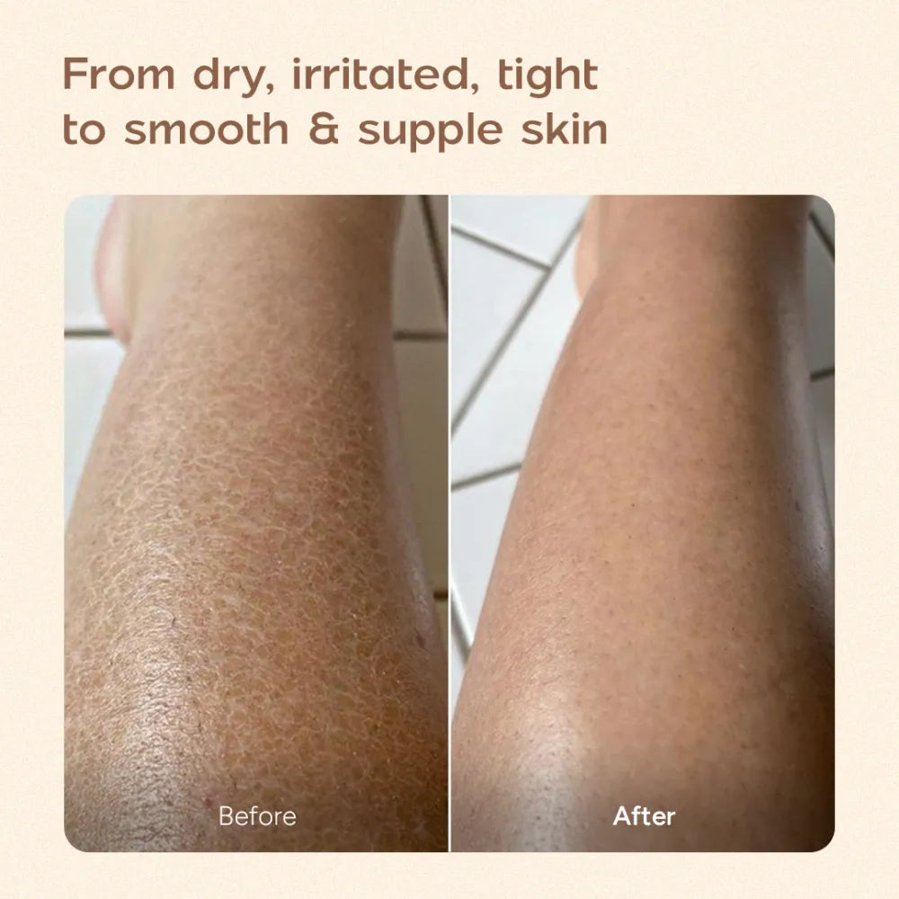 Ceramide Body Lotion for Dry and Compromised Skin 200 ml