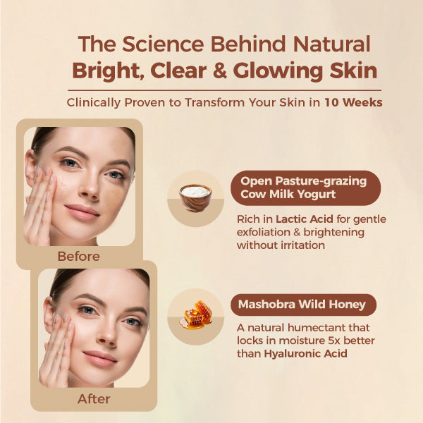 Brightening Depigmentation Gel for Reducing Pigmentation, Dark Spots and Blemishes With Cow Yogurt & Mashobra Honey - Pack of 2