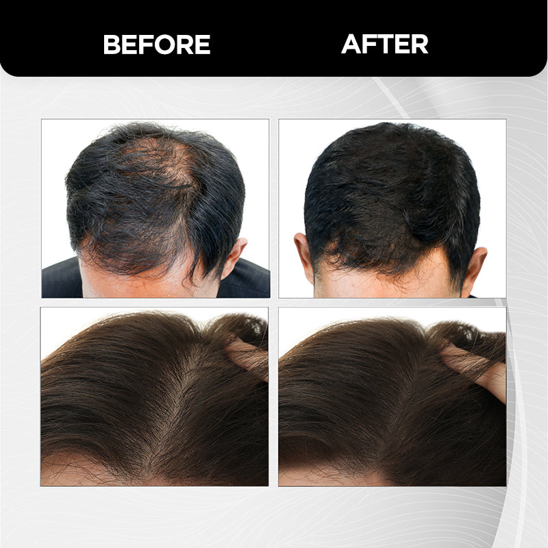 Hair Building Fibers - 12g 12g