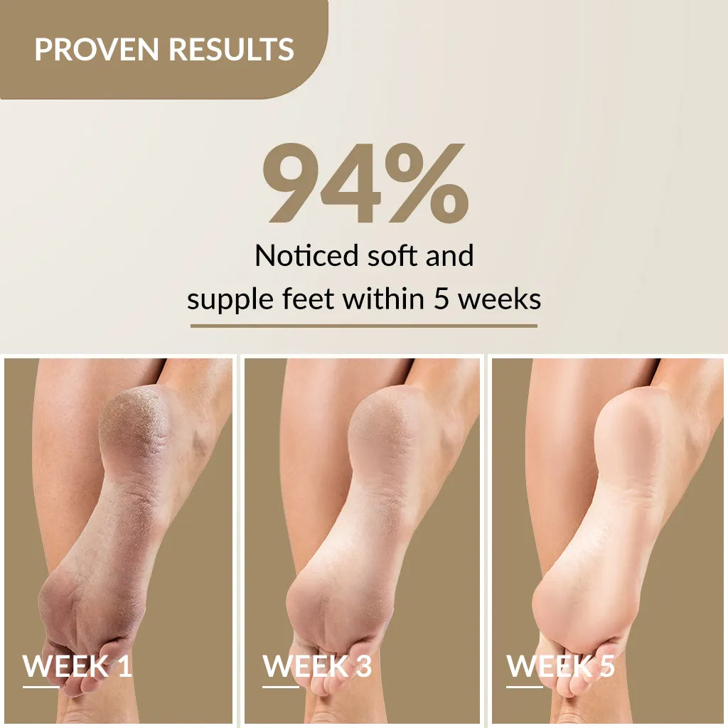Foobetik Foot Cream 50g Pack of 2 50gx2