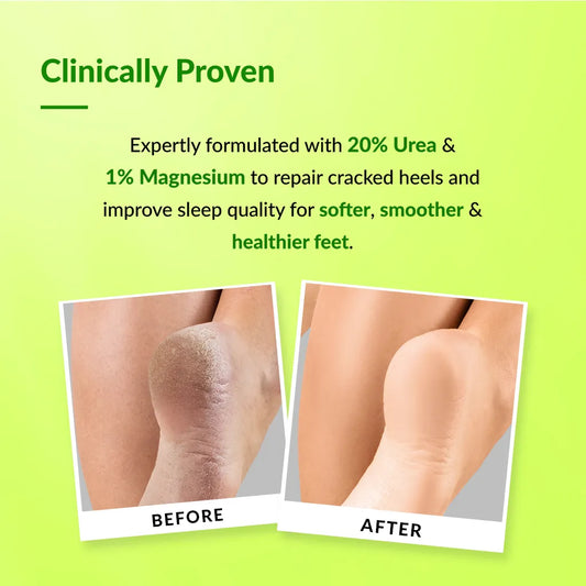 Foobetik Foot Cream Roll On