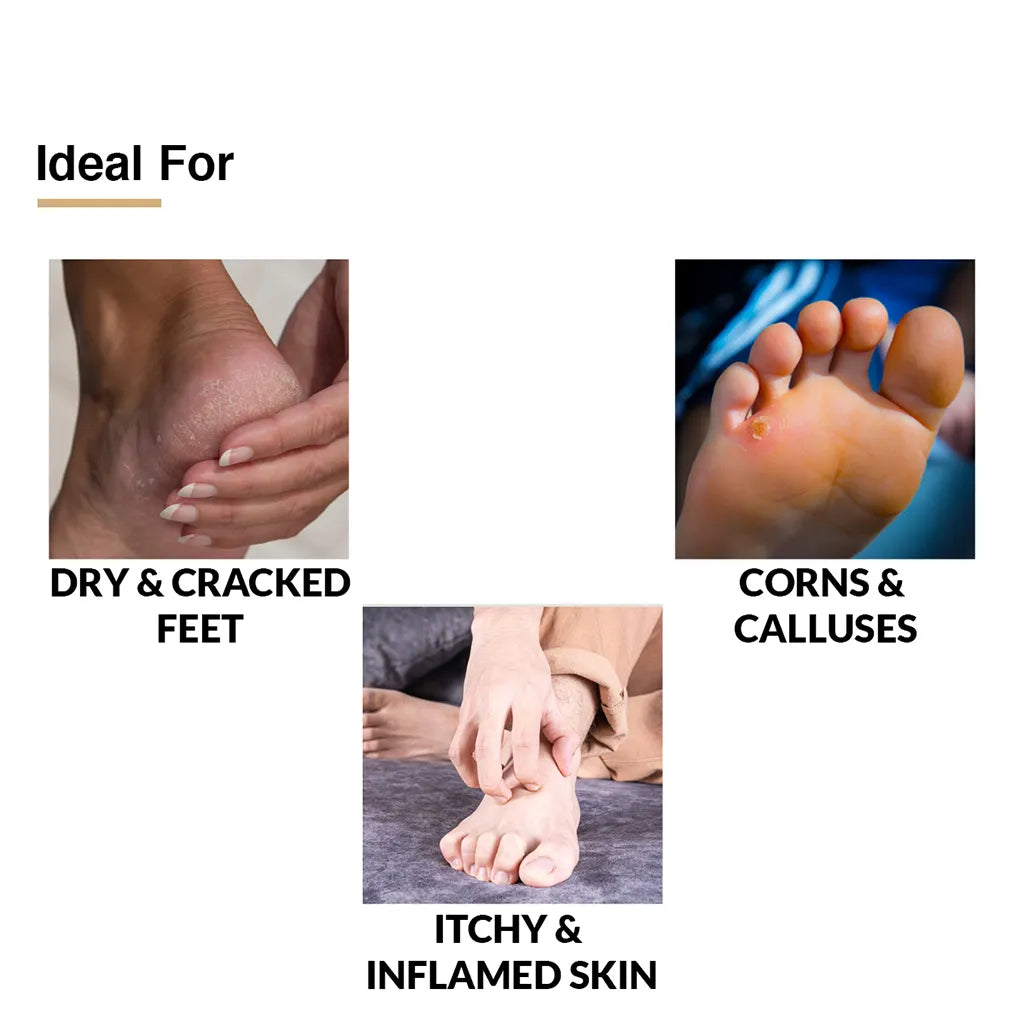 Nigrifix Cream & Foot Cream